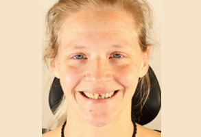 Ukiah Oral Surgery   Dental Implants | Complete Same Day Smiles, Implant Dentistry and Same Day Implants