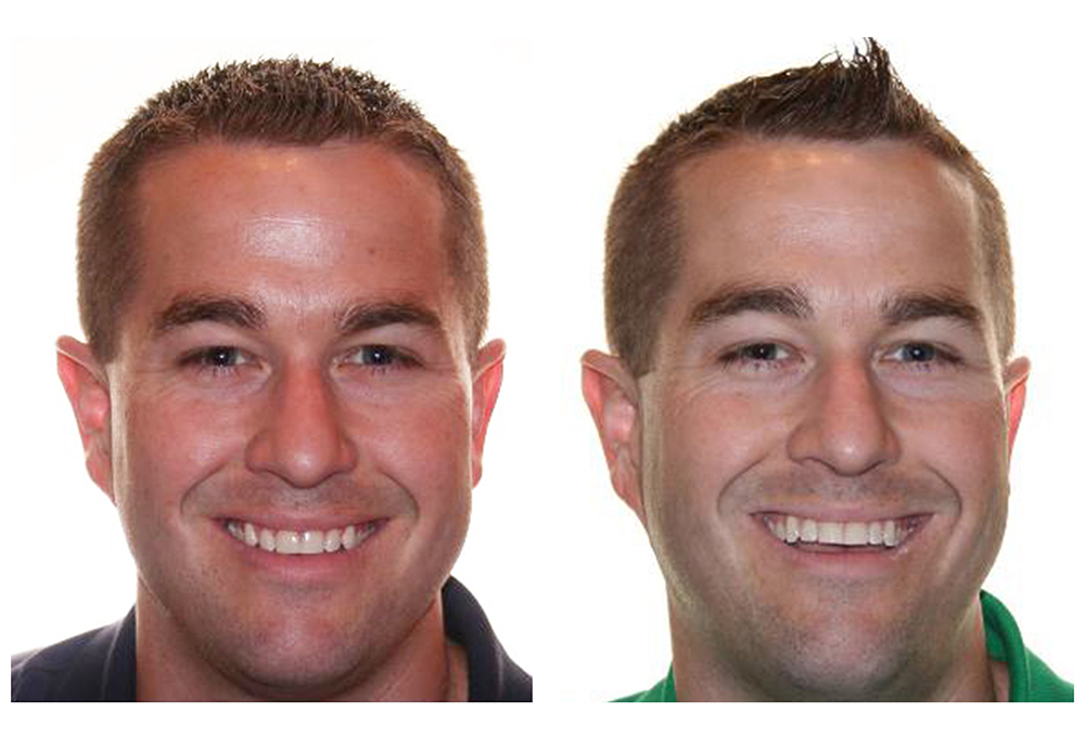 Ukiah Oral Surgery Dental Implants