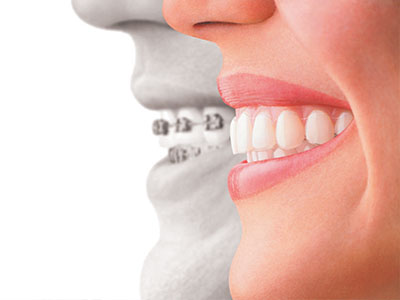 Ukiah Oral Surgery   Dental Implants | Complete Same Day Smiles, Apicoectomy and Pre-Prosthetic Surgery